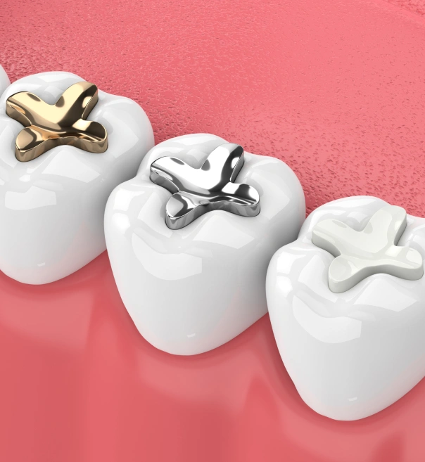 Three white tooth models with gold and silver dental crowns on pink background.