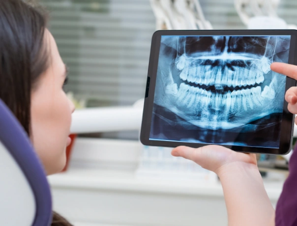 Dentist reviewing digital X-ray on tablet with patient in clinical setting.