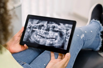 Person holding tablet displaying dental X-ray scan in clinical setting.