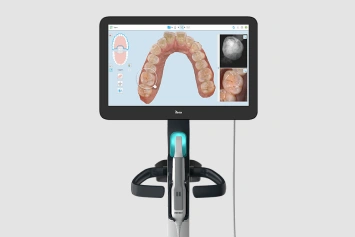 Intraoral camera displaying dental scan of patient's teeth and gums on digital screen.