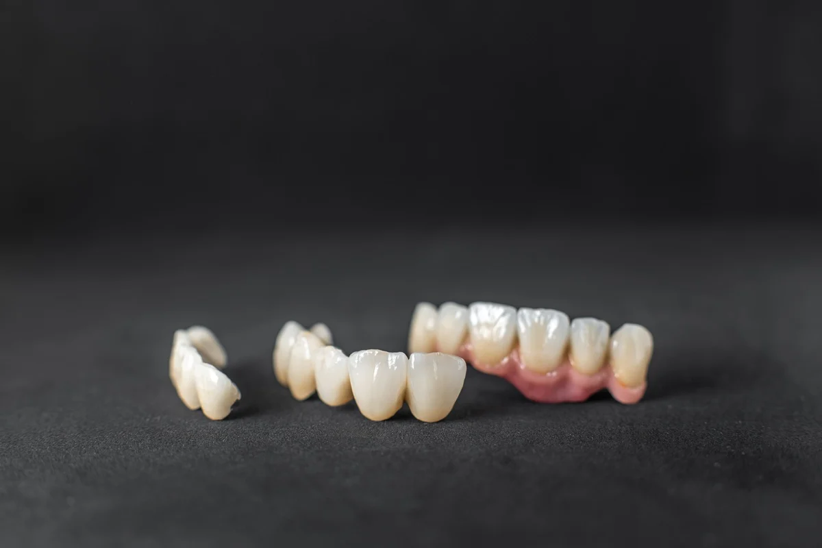 dental crowns